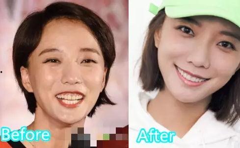 明星都用什么美白牙齿,明星美白牙齿秘籍大揭秘