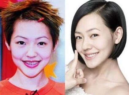 明星换脸张天,揭秘明星换脸技术背后的秘密